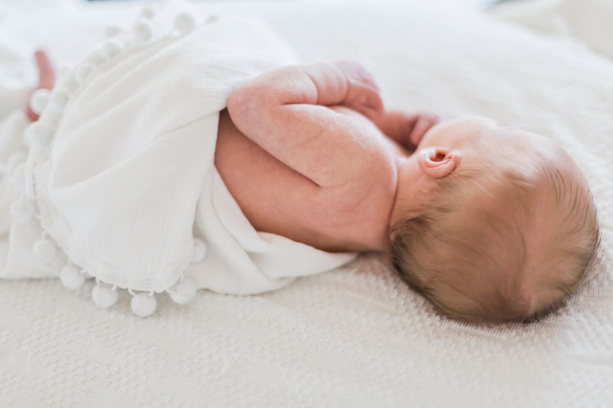 Cradle cap. Not as cute as it sounds.